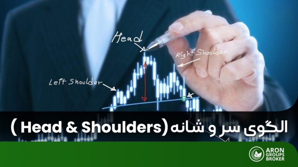 الگوی سر و شانه