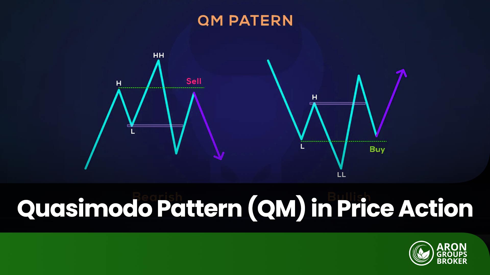 Quasimodo Pattern