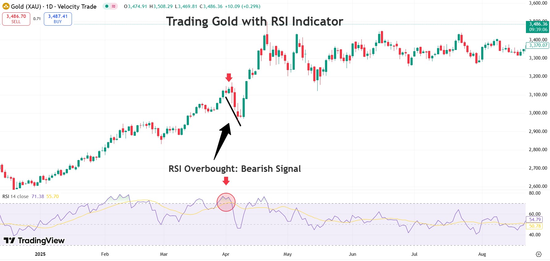 Comprehensive Guide to Risk and Capital Management in Gold Trading